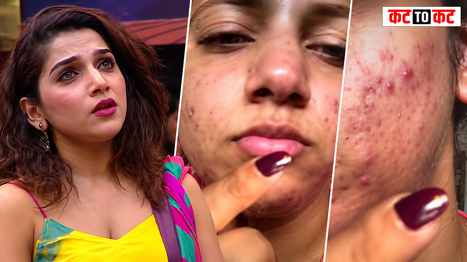 Janhvi Killekar responds to trolling over Bisleri water bath and shows skin problem photos